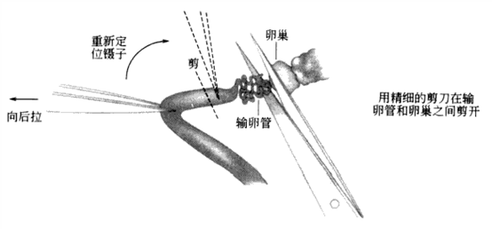1-210P509250RH.png